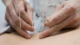 acupuncture for lumbar necrosis