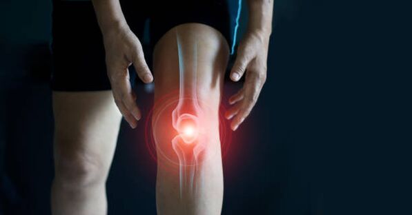 Arthrosis of knee joints