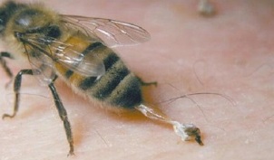 Treatment of hip joint disease with bees