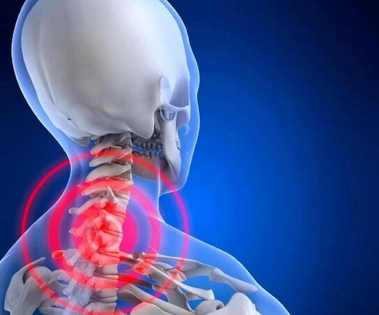 Cervical bone degeneration